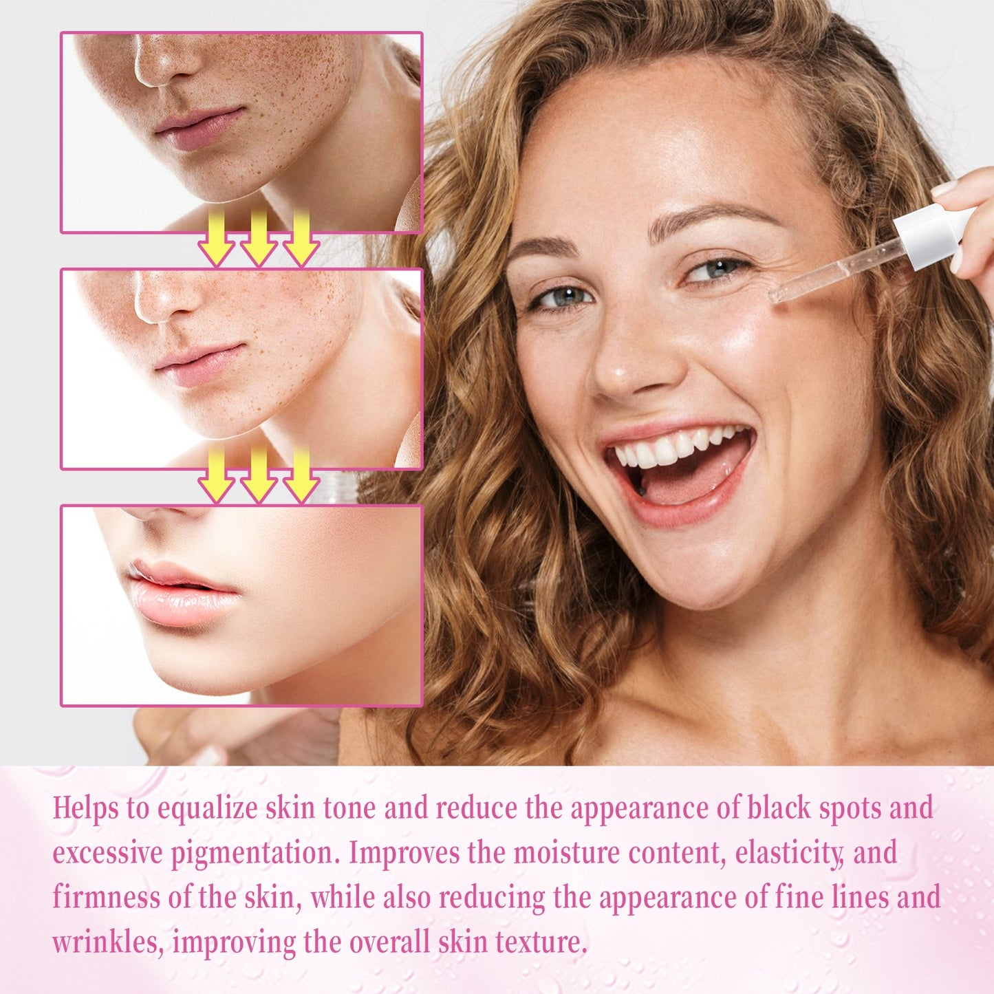 Whitening Serum Rosehip Essential Oil Pure Organic Fade Dark Spot Freckle Brighten Essence Remove Pigment Melanin Corrector 30ml