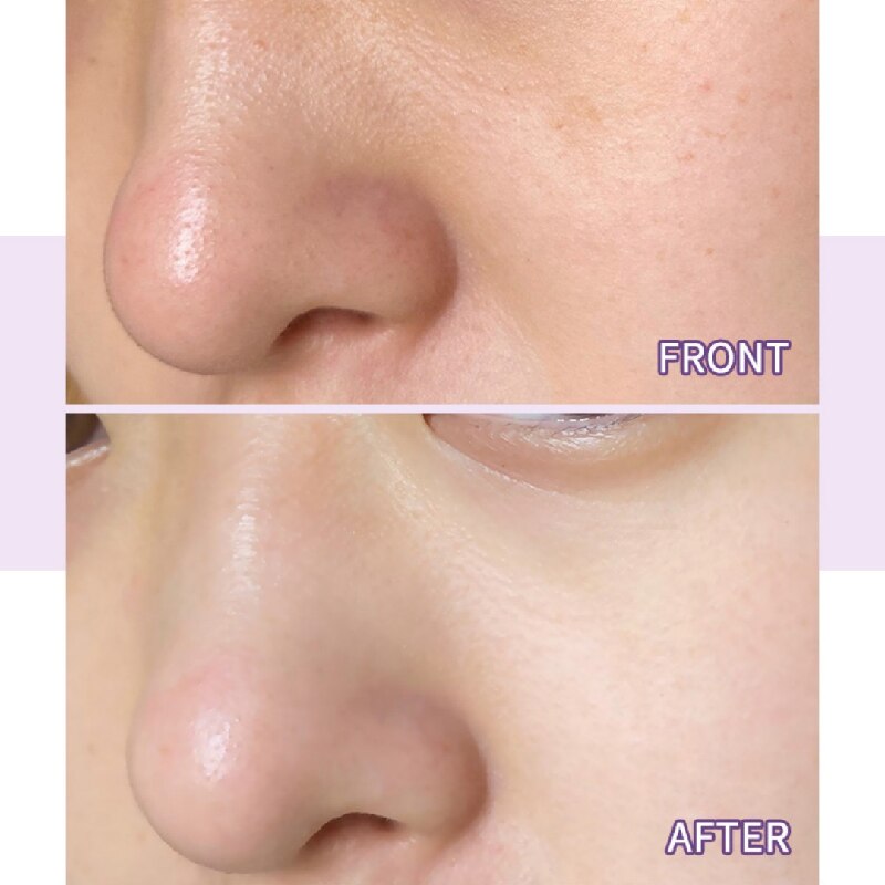 40g Skin Repair Acne Remove Mud Mask Organic Green Tea Mask Stick Clay Mask Stick Face Beauty Care Skincare Tool Women Men
