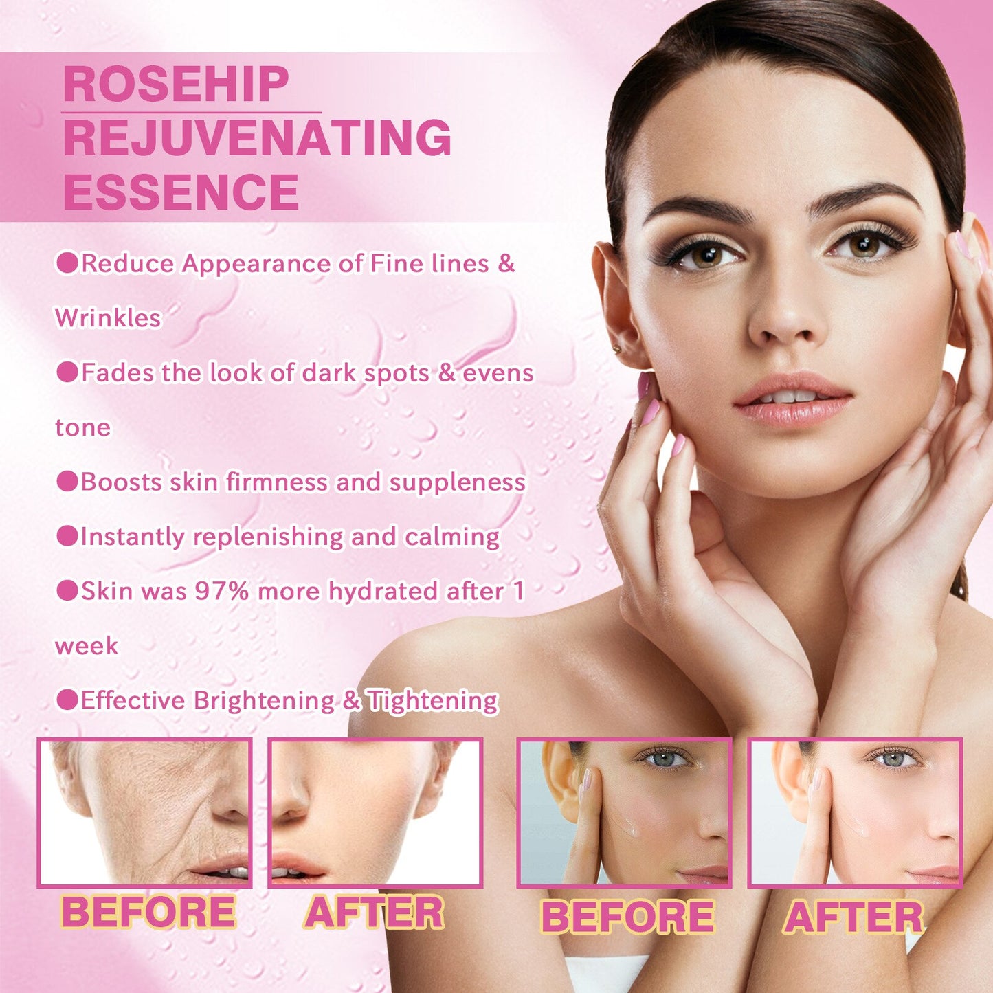Whitening Serum Rosehip Essential Oil Pure Organic Fade Dark Spot Freckle Brighten Essence Remove Pigment Melanin Corrector 30ml
