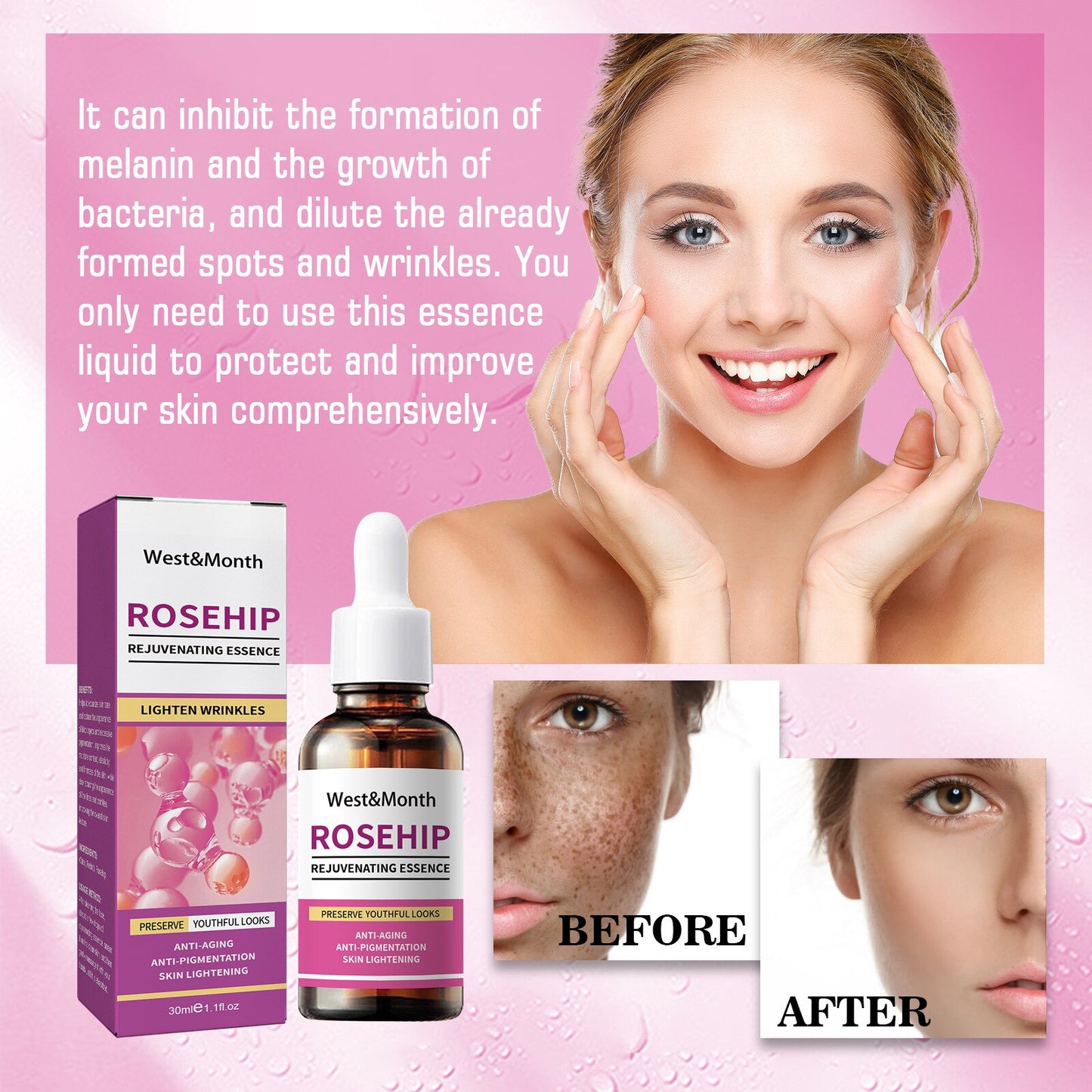 Whitening Serum Rosehip Essential Oil Pure Organic Fade Dark Spot Freckle Brighten Essence Remove Pigment Melanin Corrector 30ml